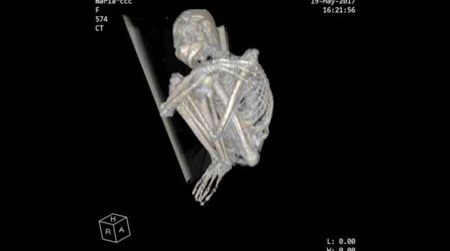 4_x_ray_of_mummy_cca67bdddfc43e542f71ffd94e6d5ca4_1600x0