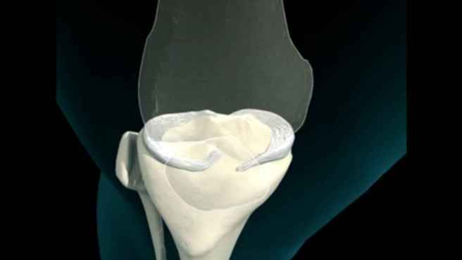 5_articular_cartilage_575bfabaf3b4b856d59d3f5f71fdb6e0_1600x0