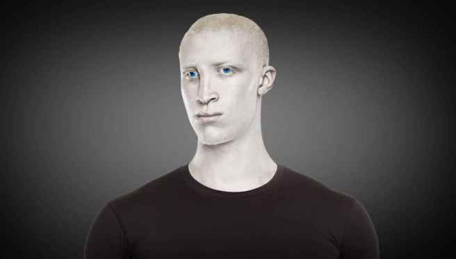4_albino_human_et_05b9221478fa4649c3a40d233197f7bb_1600x0